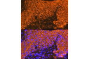 Immunofluorescence analysis of human skin using Cytokeratin 16 (KRT16) Rabbit mAb (ABIN7268094) at dilution of 1:100 (40x lens). (KRT16 antibody)