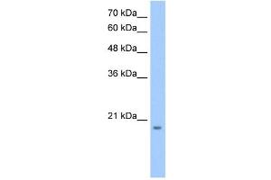 MGC4172 antibody used at 0. (MGC4172 (C-Term) antibody)