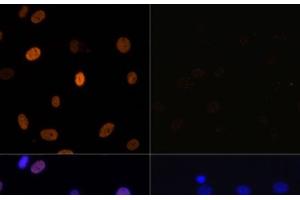 Immunofluorescence analysis of C6 cells using Acetyl-Histone H3-K9/K14/K18/K23/K27 Polyclonal Antibody at dilution of 1:100.