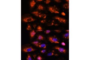 Immunofluorescence analysis of U-2 OS cells using O antibody (ABIN7265319) at dilution of 1:100. (OAS3 antibody  (AA 320-620))