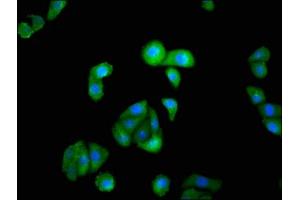 Immunofluorescence staining of HepG2 cells with ABIN7156637 at 1:100, counter-stained with DAPI. (IRF9 antibody  (AA 44-180))