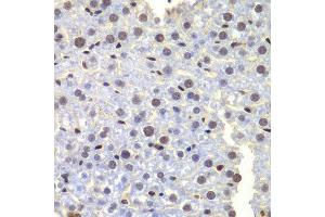 Immunohistochemistry of paraffin-embedded mouse liver using LHX4 antibody at dilution of 1:100 (x400 lens). (LHX4 antibody)