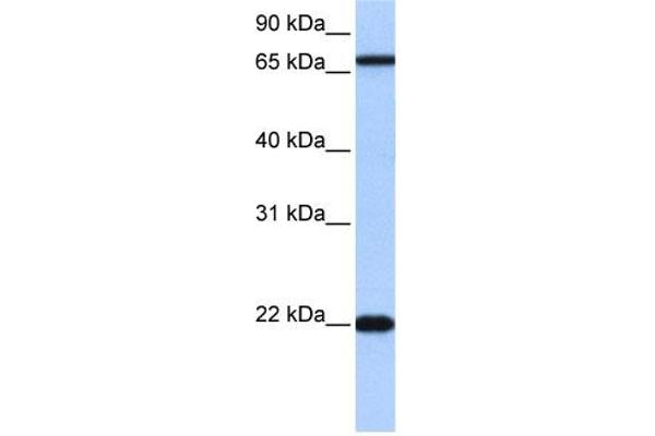 ACCSL antibody  (N-Term)