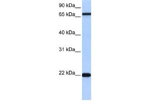 WB Suggested Anti-ACCSL Antibody Titration:  0.