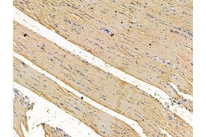 ABIN7096210 and ABIN7100272 at 1/100 staining rat muscle tissue by IHC-P. (RWDD2B antibody)