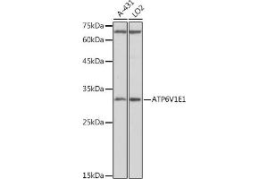 Western blot analysis of extracts of various cell lines, using V1E1 antibody (ABIN1678795, ABIN3018056, ABIN3018057 and ABIN6220346) at 1:1000 dilution. (ATP6V1E1 antibody  (AA 77-226))