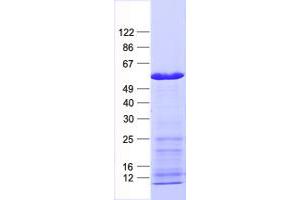 Validation with Western Blot (PSMD4/ASF Protein (His tag))