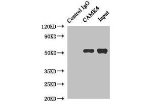 Immunoprecipitating CAMK4 in Jurkat whole cell lysate Lane 1: Rabbit control IgG instead of (1 μg) instead of ABIN7146449 in Jurkat whole cell lysate. (CAMK4 antibody  (AA 304-473))