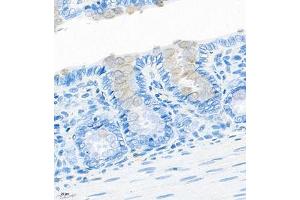 Immunohistochemistry of paraffin embedded rat colon using CNTROB (ABIN7073427) at dilution of 1:200 (400x lens) (CNTROB antibody)