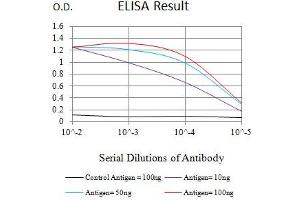 Black line: Control Antigen (100 ng),Purple line: Antigen (10 ng), Blue line: Antigen (50 ng), Red line:Antigen (100 ng) (MUC5B antibody  (AA 5630-5757))