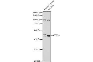 Western blot analysis of extracts of various cell lines, using CD79a antibody (ABIN1679100, ABIN3015116, ABIN3015118 and ABIN6213808) at 1:1000 dilution.