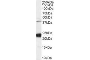 Image no. 1 for anti-GIPC PDZ Domain Containing Family, Member 1 (GIPC1) (C-Term) antibody (ABIN374381) (GIPC1 antibody  (C-Term))
