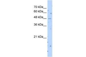 Western Blotting (WB) image for anti-Solute Carrier Family 22 (Organic Cation Transporter), Member 23 (SLC22A23) antibody (ABIN2463286)