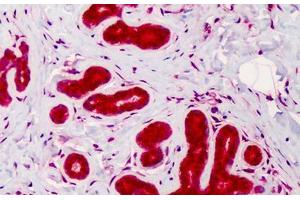 Human Breast: Formalin-Fixed, Paraffin-Embedded (FFPE) (Caspase 4 antibody)