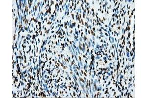 Immunohistochemical staining of paraffin-embedded Kidney tissue using anti-APP mouse monoclonal antibody. (APP antibody)