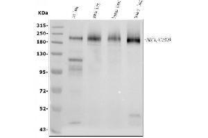 Western blot analysis of MRC1 using anti-MRC1 antibody (ABIN7600593).