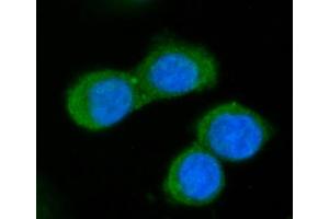 IF analysis of GGCX using anti-GGCX antibody (ABIN7602419). (GGCX antibody  (AA 75-730))