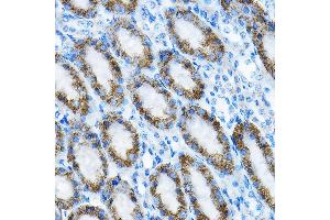 Immunohistochemistry of paraffin-embedded mouse kidney using MRPL13 Rabbit pAb  at dilution of 1:100 (40x lens). (MRPL13 antibody  (AA 1-179))