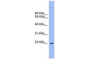 Image no. 1 for anti-Dorsal Root Ganglia Homeobox (DRGX) (AA 151-200) antibody (ABIN6744666) (DRGX antibody  (AA 151-200))