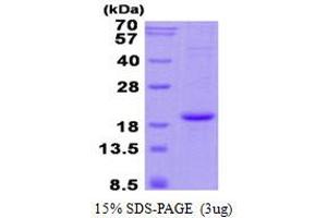 Image no. 1 for Hemoglobin, alpha 2 (HBa2) protein (His tag) (ABIN1098667)