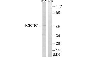 Western blot analysis of extracts from RAW264. (HCRTR1 antibody)