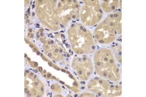 Immunohistochemistry of paraffin-embedded human kidney using BAG2 antibody at dilution of 1:100 (40x lens). (BAG2 antibody)