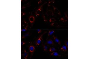 Immunofluorescence analysis of U-2 OS cells using RNF112 antibody (ABIN7270054) at dilution of 1:100. (RNF112 antibody  (AA 200-500))