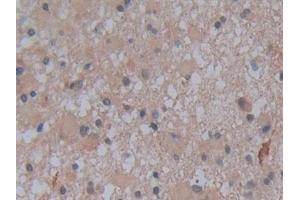 Immunohistochemistry (IHC) image for anti-Alkaline Phosphatase, Liver/bone/kidney (ALPL) (AA 18-335) antibody (ABIN7433150)