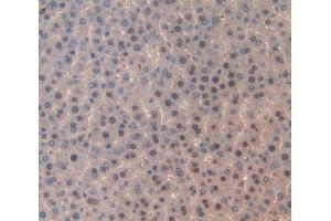 Used in DAB staining on fromalin fixed paraffin- embedded liver tissue (TOP2 antibody  (AA 1079-1328))