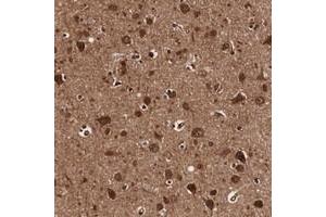 Immunohistochemical staining of human cerebral cortex with KIAA0329 polyclonal antibody  shows strong nuclear and cytoplasmic positivity in neuronal cells. (TECPR2 antibody)