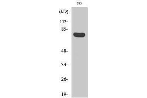 Western Blotting (WB) image for anti-rho GTPase Activating Protein 18 (ARHGAP18) (C-Term) antibody (ABIN3183356) (ARHGAP18 antibody  (C-Term))