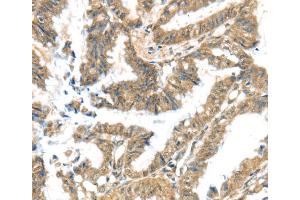 Immunohistochemistry (IHC) image for anti-Potassium Voltage-Gated Channel, Subfamily G, Member 3 (KCNG3) antibody (ABIN2433240) (KCNG3 antibody)