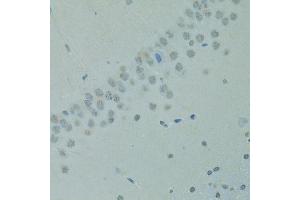 Immunohistochemistry of paraffin-embedded rat brain using CTAG1B antibody (ABIN6003542) at dilution of 1/100 (40x lens). (CTAG1B antibody)