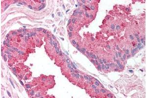 Human Prostate (formalin-fixed, paraffin-embedded) stained with SAP18 antibody ABIN214141 at 5 ug/ml followed by biotinylated goat anti-rabbit IgG secondary antibody ABIN481713, alkaline phosphatase-streptavidin and chromogen. (SAP18 antibody  (AA 30-79))