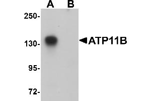 Western Blotting (WB) image for anti-ATPase, Class VI, Type 11B (ATP11B) (N-Term) antibody (ABIN1031250) (ATP11B antibody  (N-Term))