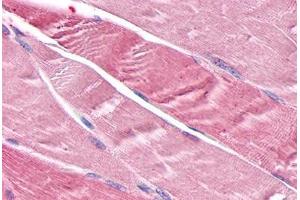 Anti-TNIK antibody  ABIN1049422 IHC staining of human skeletal muscle, myocytes.