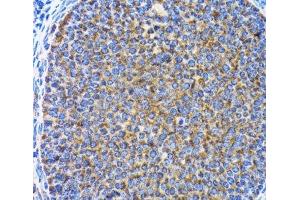 Immunohistochemistry of paraffin-embedded Rat ovary using MAP1LC3A Polyclonal Antibody at dilution of 1:100 (40x lens). (MAP1LC3A antibody)