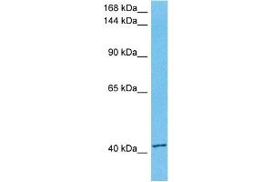 Host:  Rabbit  Target Name:  UBR3  Sample Tissue:  Human Jurkat Whole Cell lysates  Antibody Dilution:  1ug/ml (Zinc Finger Protein 650 (ZNF650) (C-Term) antibody)