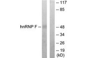 Western blot analysis of extracts from HepG2 cells, using hnRNP F Antibody. (HNRNPF antibody  (AA 11-60))