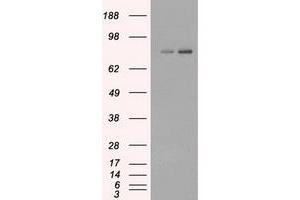 Image no. 1 for anti-Fermitin Family Member 2 (FERMT2) antibody (ABIN1499050) (FERMT2 antibody)