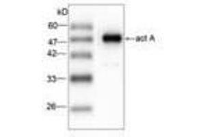 Image no. 1 for anti-Listeria Monocytogenes ActA (AA 117-278) antibody (ABIN791620) (Listeria Monocytogenes ActA (AA 117-278) antibody)