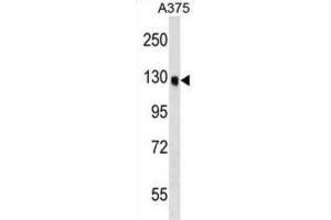 Western Blotting (WB) image for anti-Oxysterol Binding Protein-Like 6 (OSBPL6) antibody (ABIN2999484)