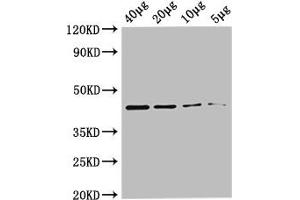 Western Blot Positive WB detected in: Rosseta bacteria lysate at 40 μg, 20 μg, 10 μg, 5 μg All lanes: metC antibody at 0. (MetC (AA 1-392) antibody (Biotin))