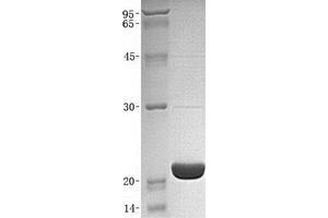 Western Blotting (WB) image for Interleukin 1 Receptor Antagonist (IL1RN) (Transcript Variant 3) protein (ABIN2723403)
