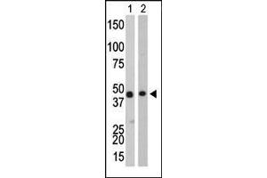 The anti-CKB Pab (ABIN391074 and ABIN2841221) is used in Western blot to detect CKB in Y79 cell lysate (Lane 1) and mouse colon tissue lysate (Lane 2). (CKB antibody  (C-Term))