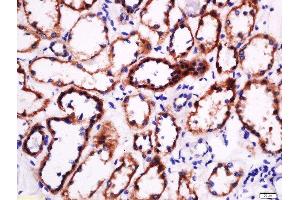 Immunohistochemistry (Paraffin-embedded Sections) (IHC (p)) image for anti-Laminin (LN) (AA 901-1000) antibody (ABIN728638)