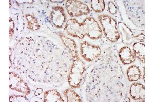 Paraformaldehyde-fixed, paraffin embedded human kidney, Antigen retrieval by boiling in sodium citrate buffer (pH6) for 15min, Block endogenous peroxidase by 3% hydrogen peroxide for 30 minutes, Blocking buffer (normal goat serum) at 37°C for 20min, Antibody incubation with Alpha-ENaC Polyclonal Antibody, Unconjugated  at 1:200 overnight at 4°C, followed by a conjugated secondary and DAB staining. (SCNN1A antibody  (AA 201-300))