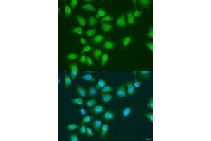 Immunofluorescence analysis of U2OS cells using EY antibody (ABIN7267073) at dilution of 1:100. (EYA3 antibody  (AA 1-300))