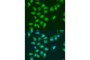 Immunofluorescence analysis of U2OS cells using EY antibody (ABIN7267073) at dilution of 1:100.