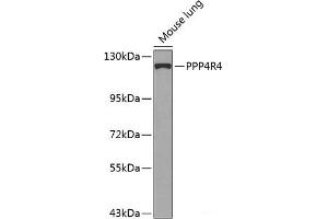Western blot analysis of extracts of Mouse lung using PPP4R4 Polyclonal Antibody at dilution of 1:1000. (PPP4R4 antibody)